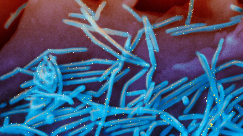 FILE - This electron microscope image provided by the National Institutes of Health shows...