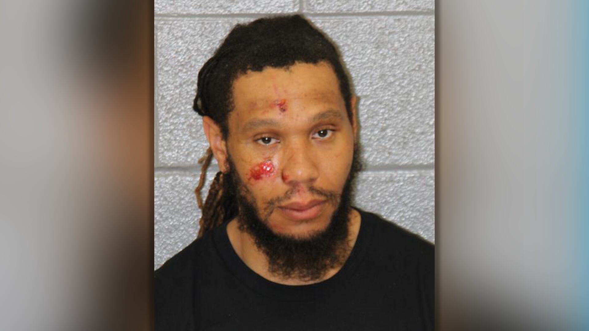 Man seriously hurt, charged after slamming into tree while running from officers in Matthews - Vimarsana News