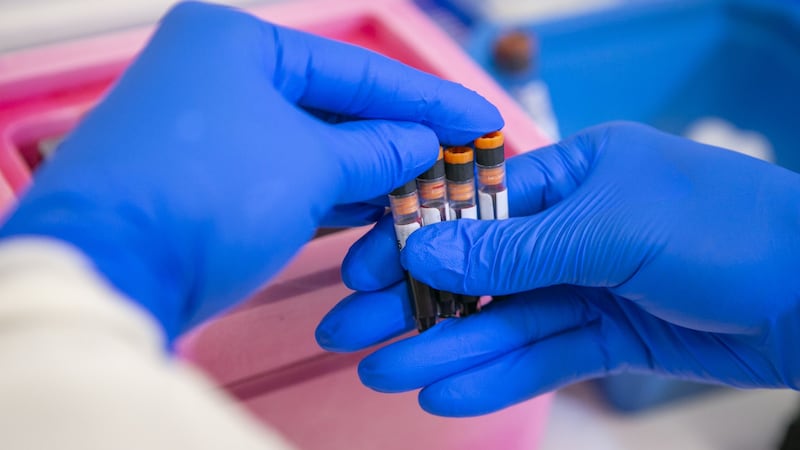 Duke researchers are using MURDOCK Study samples to better understand Alzheimer’s disease and...